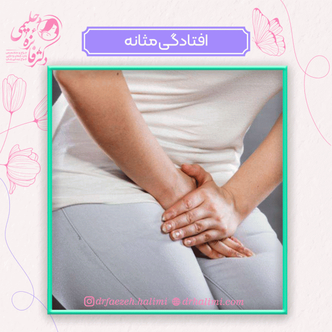 افتادگی مثانه