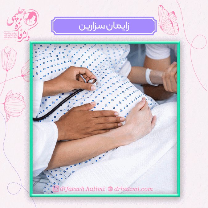 زایمان سزارین