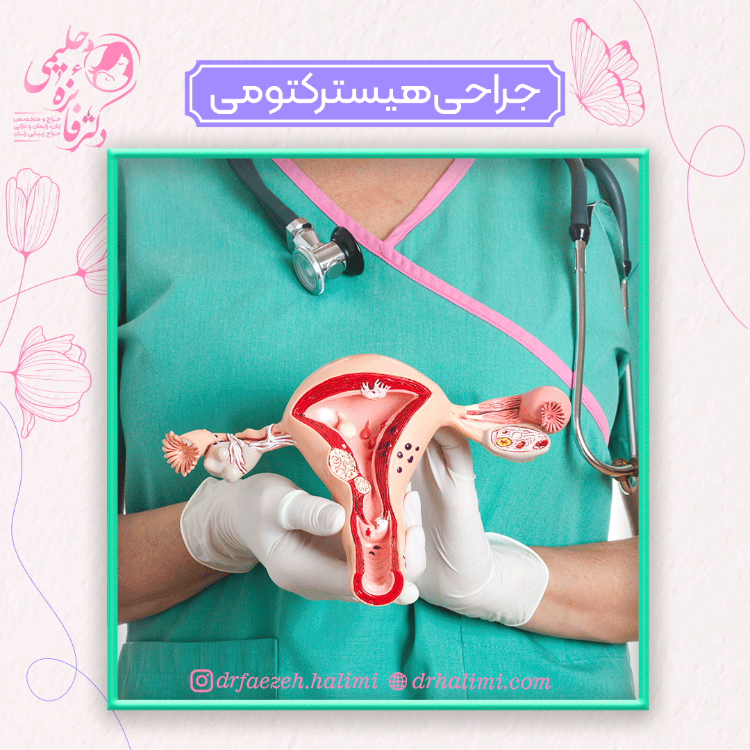 جراحی هیسترکتومی