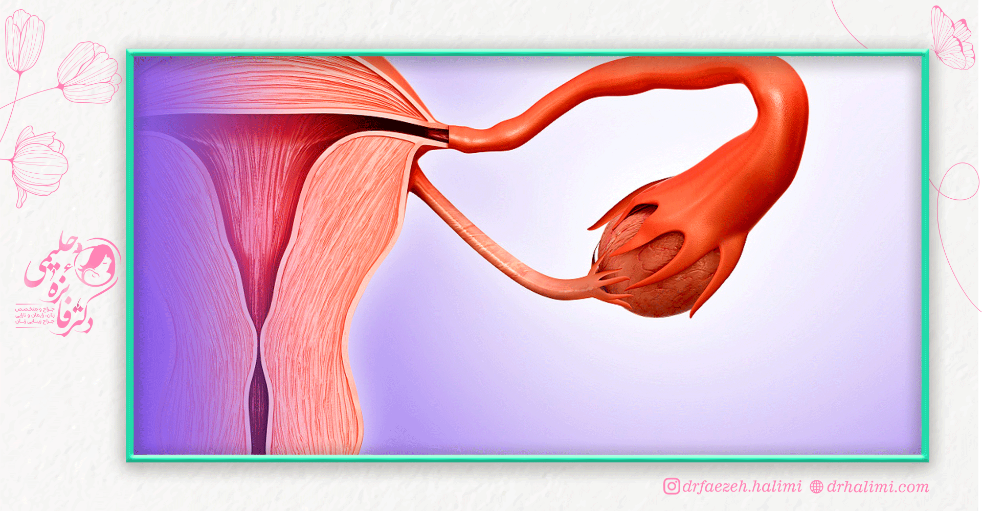 عمل جراحی میومکتومی برای چه کسانی لازم است؟
