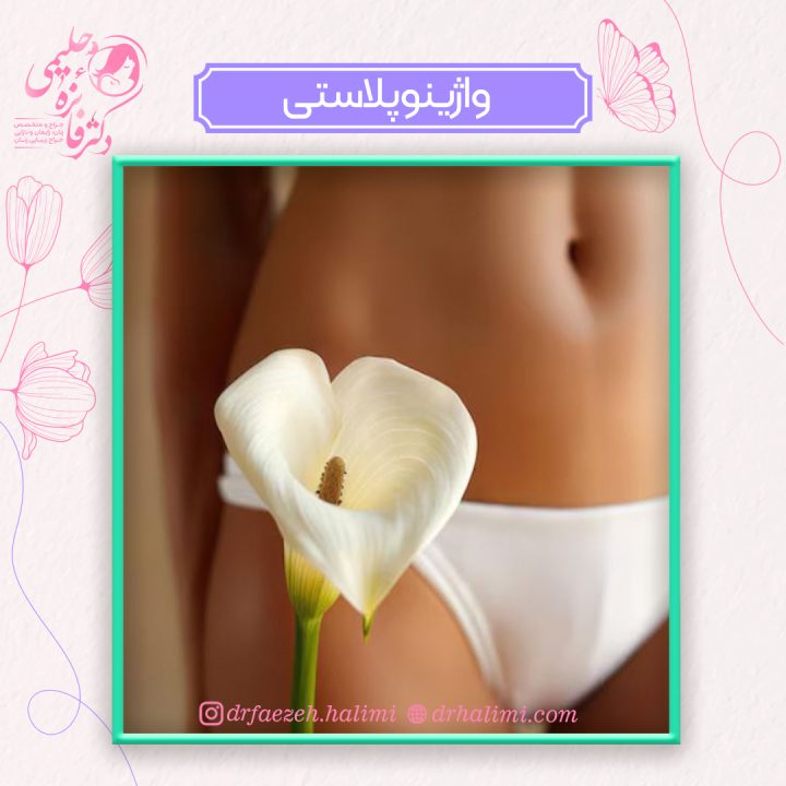 جراحی واژینوپلاستی روشی برای تنگ کردن واژن و رفع گشادی ناحیه تناسلی زنان