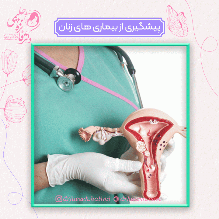 پیشگیری از بیماری های زنان