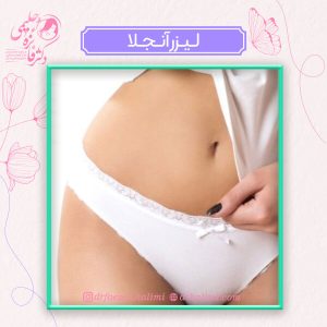 لیزر آنجلا چیست؟