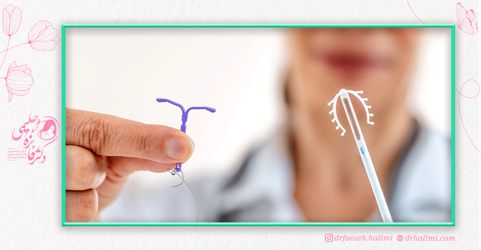 کارگذاری IUD در رحم چگونه است؟