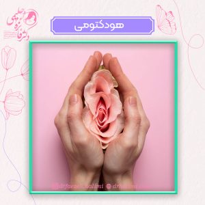 جراحی هودکتومی