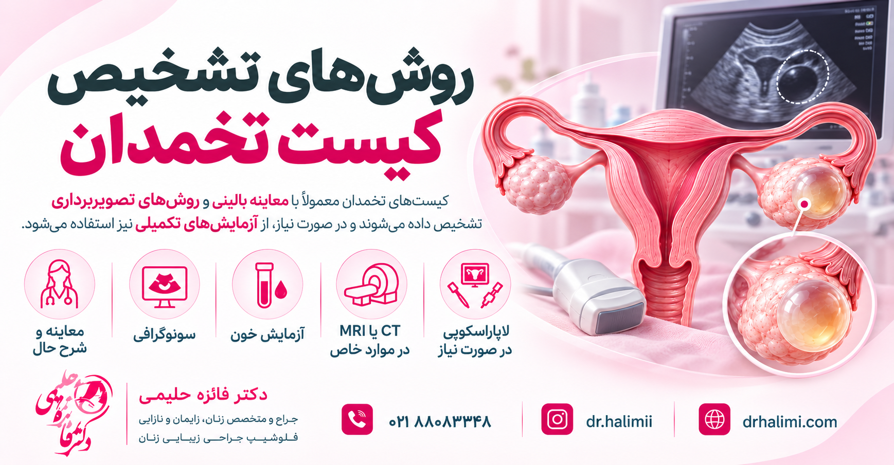 روش‌های تشخیص کیست تخمدان