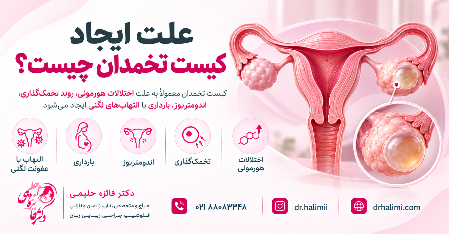 علت ایجاد کیست تخمدان چیست؟
