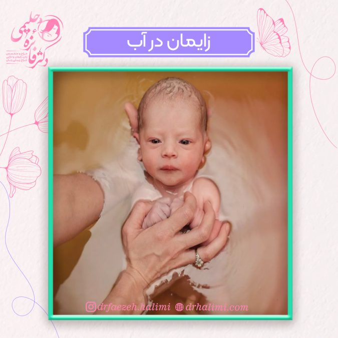 زایمان در آب