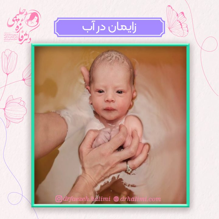 زایمان در آب
