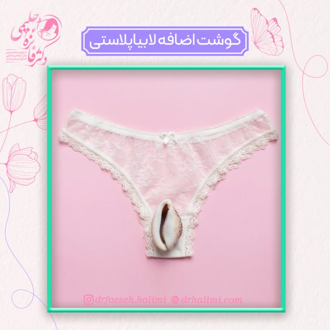 گوشت اضافه بعد از لابیاپلاستی