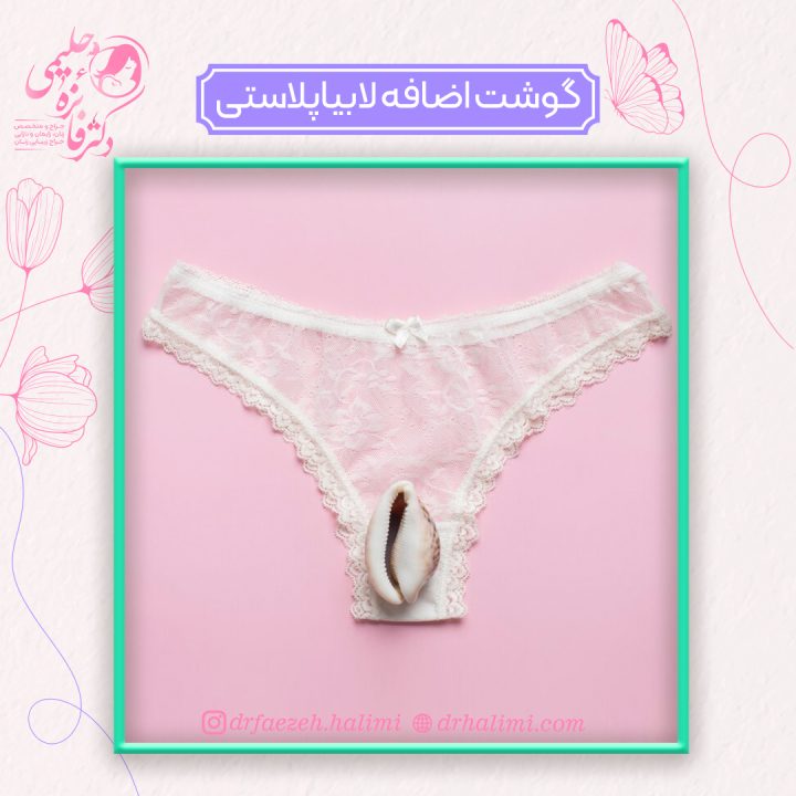 گوشت اضافه بعد از لابیاپلاستی
