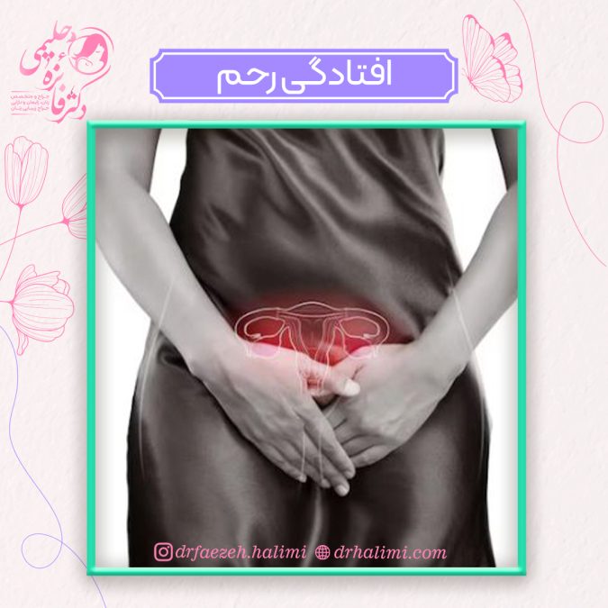 افتادگی رحم چیست؟ جلوگیری و درمان افتادگی رحم