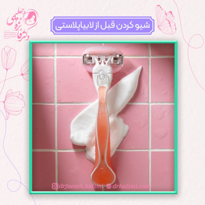 شیو کردن قبل از لابیاپلاستی