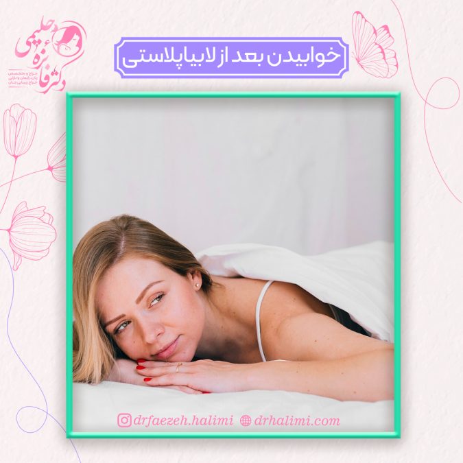 نحوه خوابیدن بعد از لابیاپلاستی