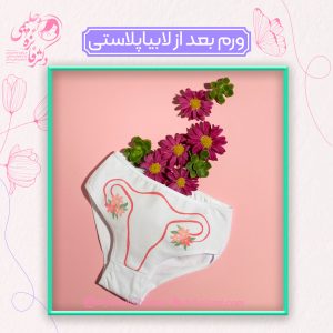 درمان ورم بعد از لابیاپلاستی