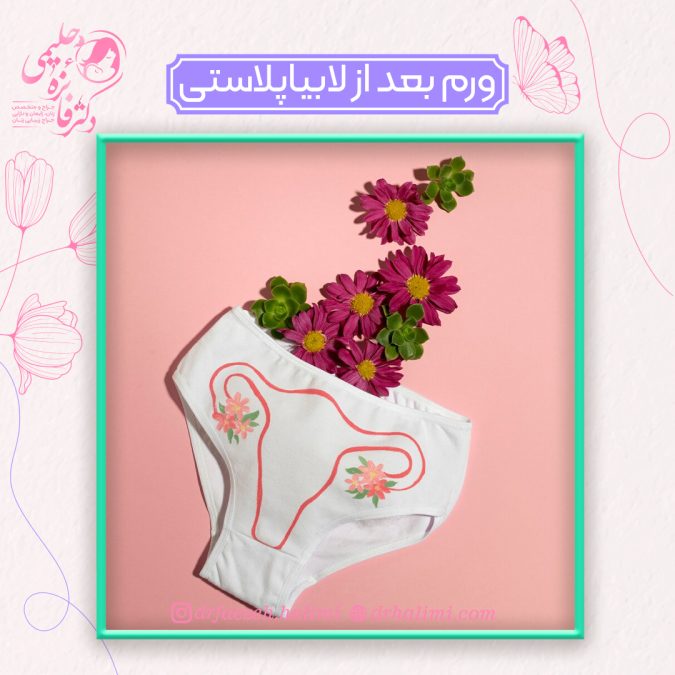 درمان ورم بعد از لابیاپلاستی