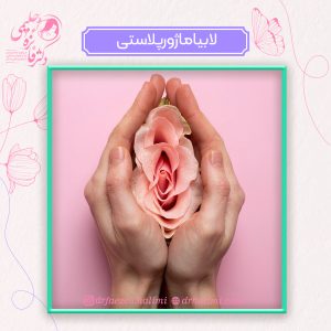 جراحی لابیاماژورپلاستی