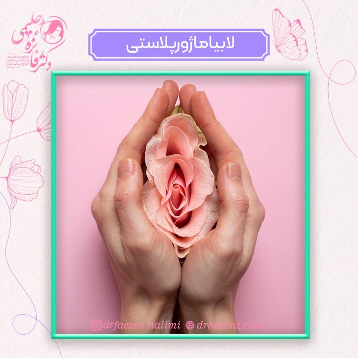 جراحی لابیاماژورپلاستی