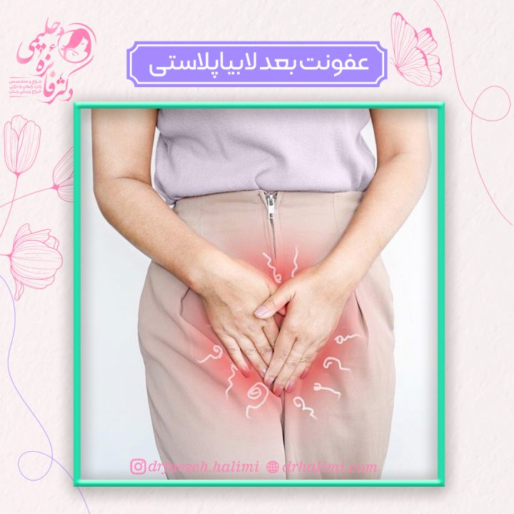 عفونت بعد از لابیاپلاستی