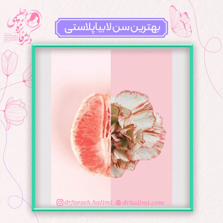 بهترین سن لابیاپلاستی