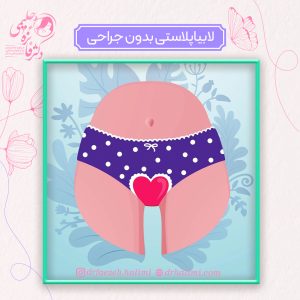 لابیاپلاستی بدون جراحی