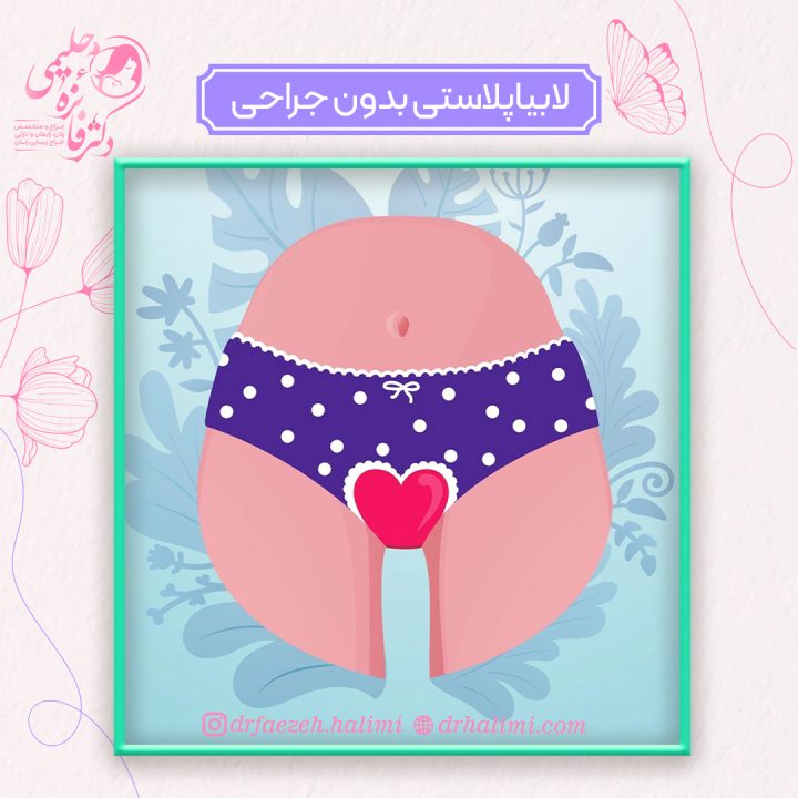 لابیاپلاستی بدون جراحی