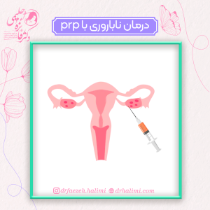 درمان ناباروری با prp تخمدان