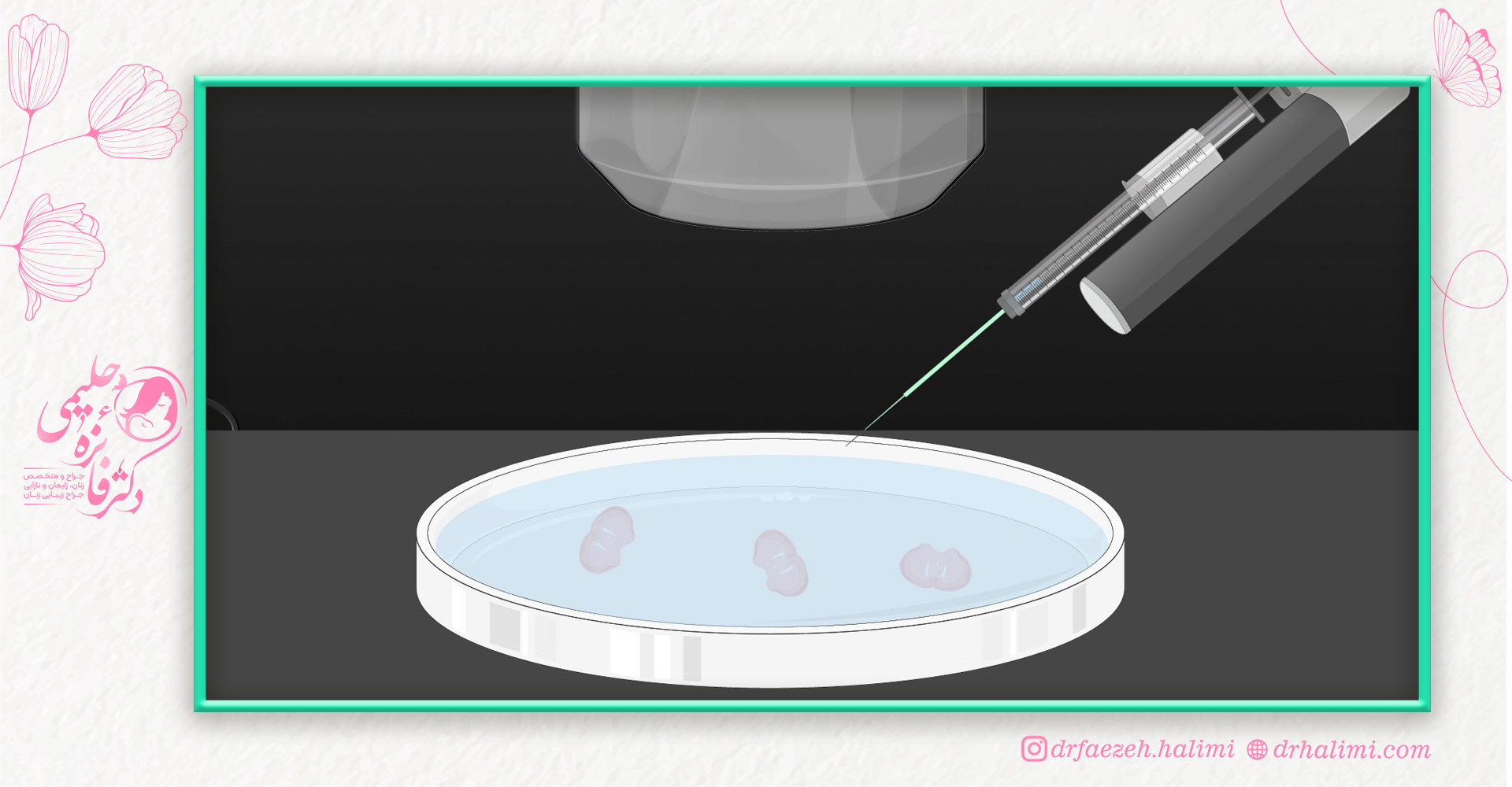 میکروانجکشن چیست؟
