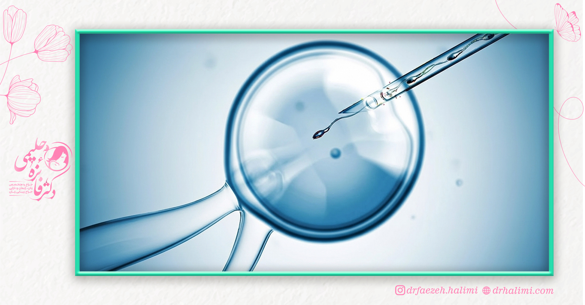 معایب آی وی اف