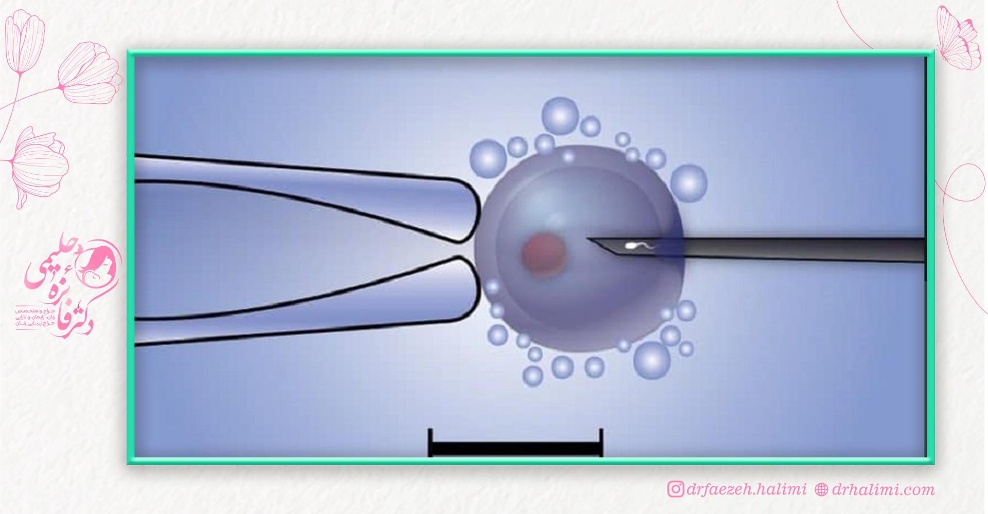 عوارض و چالش های میکروانجکشن