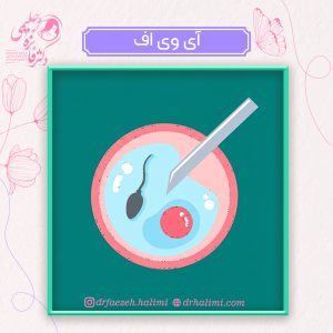آی وی اف