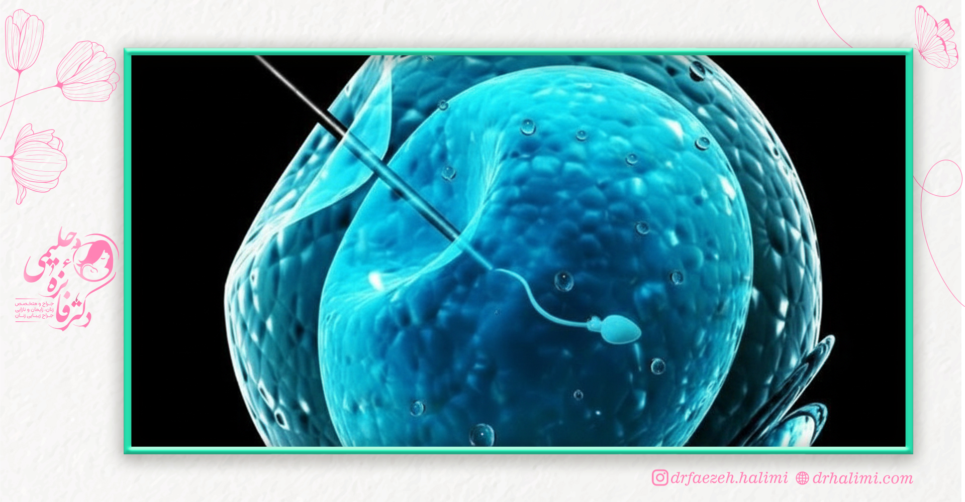 عوامل موثر بر هزینه IVF