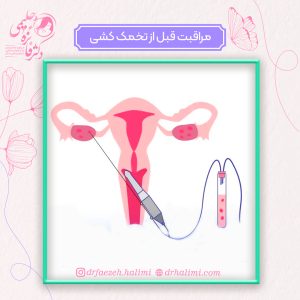 مراقبت های قبل از تخمک کشی