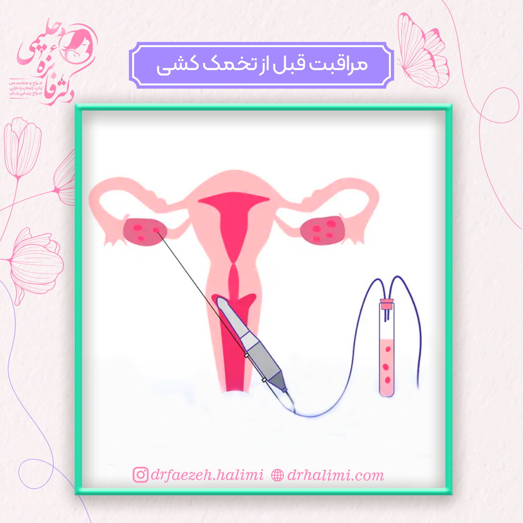 مراقبت های قبل از تخمک کشی