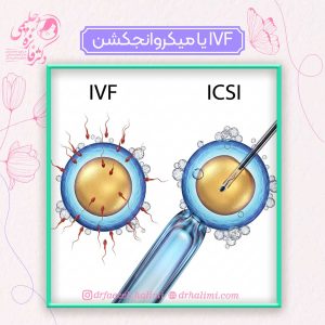 IVF یا میکروانجکشن