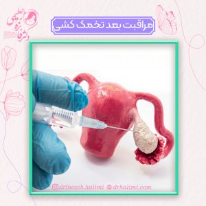 مراقبت های بعد از تخمک کشی